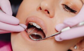 teeth